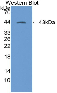 KRT7 / CK7 / Cytokeratin 7 Antibody - Western blot of recombinant KRT7 / CK7 / Cytokeratin 7.