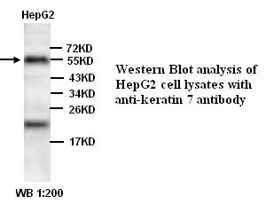 KRT7 / CK7 / Cytokeratin 7 Antibody