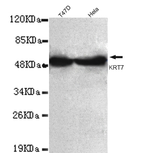 KRT7 / CK7 / Cytokeratin 7 Antibody - KRT7 (C-terminus) antibody at 1/1000 dilution Lane 1:T47D whole cell lysate 40 ug/lane Lane 2:HeLa cell lysate 40 ug/lane.