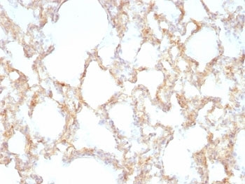 KRT7 / CK7 / Cytokeratin 7 Antibody - Formalin-fixed, paraffin-embedded rat lung stained with Keratin 7 antibody (KRT7/1198).  This image was taken for the unmodified form of this product. Other forms have not been tested.