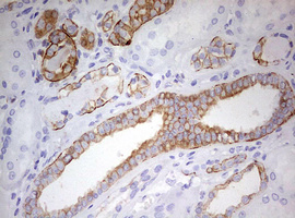 KRT7 / CK7 / Cytokeratin 7 Antibody - IHC of paraffin-embedded Human Kidney tissue using anti-KRT7 mouse monoclonal antibody. (Heat-induced epitope retrieval by 10mM citric buffer, pH6.0, 120°C for 3min).