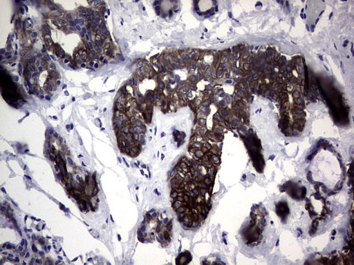 KRT7 / CK7 / Cytokeratin 7 Antibody - IHC of paraffin-embedded Human breast tissue using anti-KRT7 mouse monoclonal antibody. (Heat-induced epitope retrieval by 1 mM EDTA in 10mM Tris, pH9.0, 120°C for 3min).