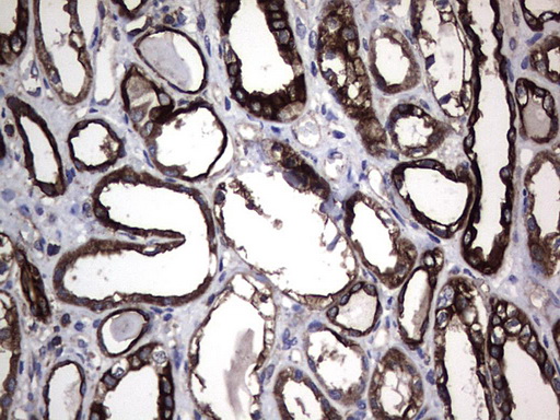 KRT7 / CK7 / Cytokeratin 7 Antibody - IHC of paraffin-embedded Human Kidney tissue using anti-KRT7 mouse monoclonal antibody. (Heat-induced epitope retrieval by 1 mM EDTA in 10mM Tris, pH9.0, 120°C for 3min).
