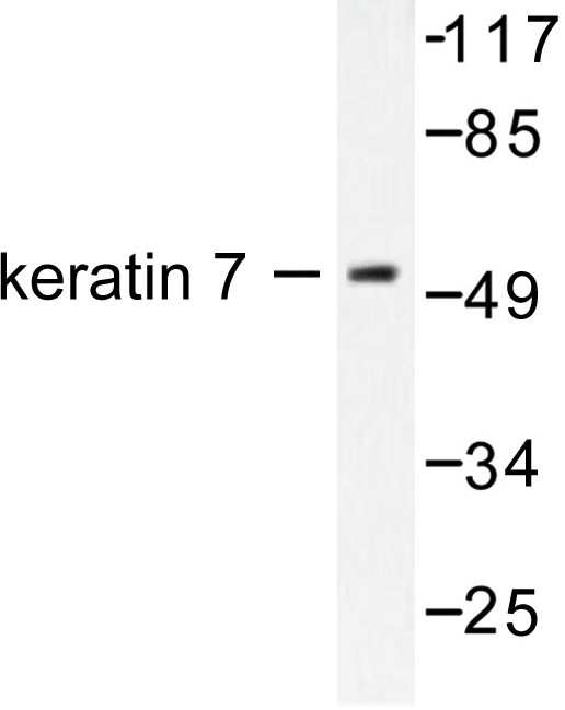 KRT7 / CK7 / Cytokeratin 7 Antibody - Western blot of Cytokeratin 7 (L451) pAb in extracts from HepG2 cells.