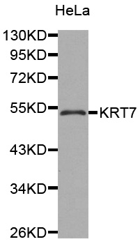 KRT7 / CK7 / Cytokeratin 7 Antibody - Western blot analysis of extracts of HeLa cells.