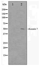 KRT7 / CK7 / Cytokeratin 7 Antibody - Western blot of HepG2 cell lysate using Keratin 7 Antibody
