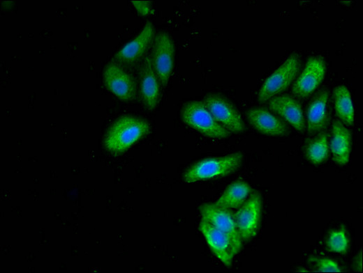 KRT7 / CK7 / Cytokeratin 7 Antibody - Immunofluorescent analysis of HepG2 cells using KRT7 Antibody at a dilution of 1:100 and Alexa Fluor 488-congugated AffiniPure Goat Anti-Rabbit IgG(H+L)