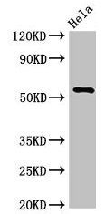 KRT7 / CK7 / Cytokeratin 7 Antibody - Western Blot Positive WB detected in: Hela whole cell lysate All lanes: KRT7 antibody at 3µg/ml Secondary Goat polyclonal to rabbit IgG at 1/50000 dilution Predicted band size: 52 kDa Observed band size: 52 kDa