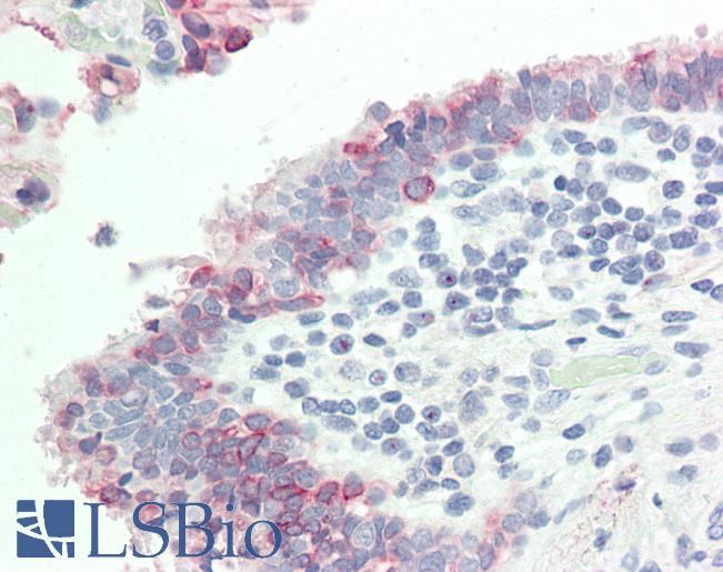 KRT7 / CK7 / Cytokeratin 7 Antibody - Human, Lung: Formalin-Fixed Paraffin-Embedded (FFPE).  This image was taken for the unconjugated form of this product. Other forms have not been tested.