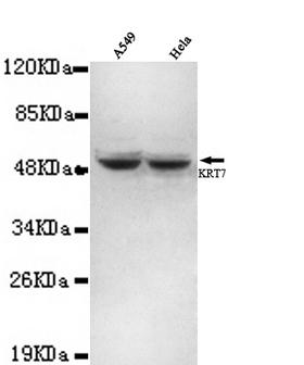 KRT7 / CK7 / Cytokeratin 7 Antibody - KRT7 (N-terminus) antibody at 1/3000 dilution Lane1: A459 whole cell lysate 40 ug/Lane Lane2: HeLa whole cell lysate 40 ug/Lane.