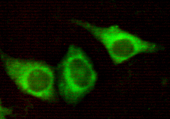 KRT7 / CK7 / Cytokeratin 7 Antibody - Immunocytochemistry of HeLa cells using anti- Keratin 7(N-terminus) antibody diluted 1:150.
