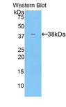KRT71 / Keratin 71 Antibody - Western blot of recombinant KRT71.