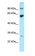 KRT71 / Keratin 71 Antibody - KRT71 antibody Western Blot of 293T.  This image was taken for the unconjugated form of this product. Other forms have not been tested.
