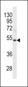 KRT72 / Keratin 72 / K6irs Antibody - KRT72 Antibody western blot of human Uterus tissue lysates (35 ug/lane). The KRT72 antibody detected the KRT72 protein (arrow).