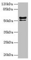KRT72 / Keratin 72 / K6irs Antibody - Western blot All lanes: KRT72 antibody at 2µg/ml + MCF-7 whole cell lysate Secondary Goat polyclonal to rabbit IgG at 1/10000 dilution Predicted band size: 56, 52 kDa Observed band size: 56, 52 kDa