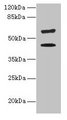 KRT73 / Keratin 73 Antibody - Western blot All lanes: KRT73 antibody at 4µg/ml + HepG2 whole cell lysate Secondary Goat polyclonal to rabbit IgG at 1/10000 dilution Predicted band size: 59, 42 kDa Observed band size: 59 kDa