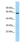 KRT74 / Keratin 74 Antibody - KRT74 antibody Western Blot of 721_B.  This image was taken for the unconjugated form of this product. Other forms have not been tested.