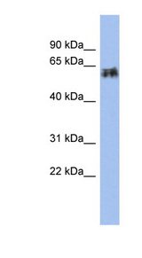 KRT75 / Keratin 75 / K6HF Antibody - KRT75 antibody Western blot of Fetal Small Intestine lysate. This image was taken for the unconjugated form of this product. Other forms have not been tested.