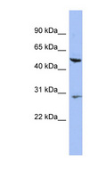 KRT75 / Keratin 75 / K6HF Antibody - KRT75 antibody Western blot of HT1080 cell lysate. This image was taken for the unconjugated form of this product. Other forms have not been tested.