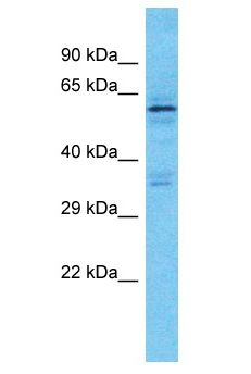 KRT76 / Keratin 76 Antibody - KRT76 / Keratin 76 antibody Western Blot of HeLa. Antibody dilution: 1 ug/ml.  This image was taken for the unconjugated form of this product. Other forms have not been tested.