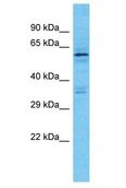 KRT76 / Keratin 76 Antibody - KRT76 / Keratin 76 antibody Western Blot of HeLa. Antibody dilution: 1 ug/ml.  This image was taken for the unconjugated form of this product. Other forms have not been tested.