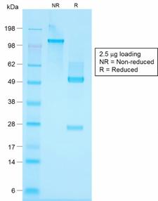 KRT76 / Keratin 76 Antibody - SDS-PAGE Analysis Purified Cytokeratin, HMW Rabbit Recombinant Monoclonal Antibody (KRTH/1576R). Confirmation of Purity and Integrity of Antibody.
