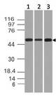 KRT76 / Keratin 76 Antibody - Fig-1: Expression analysis of KRT76. Anti-KRT76 antibody was tested at 0.5 µg/ml on Hela, MCF7 and A431 lysates.