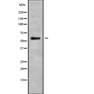 KRT76 / Keratin 76 Antibody - Western blot analysis of K22O using HepG2 whole cells lysates