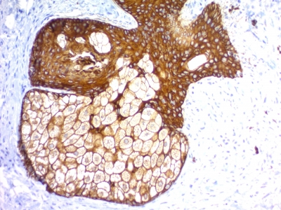 KRT76 + KRT77 Antibody - Formalin-fixed, paraffin-embedded human Skin stained with Pan-Cytokeratin Recombinant Rabbit Monoclonal Antibody (KRTH/1576R + KRTL/1577R).