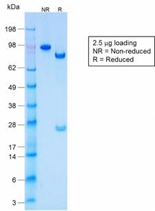 KRT77 / Keratin 77 / KRT1B Antibody - SDS-PAGE Analysis Purified CK LMW Rabbit Recombinant Monoclonal Antibody (KRTL/1577R). Confirmation of Purity and Integrity of Antibody.