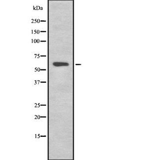 KRT77 / Keratin 77 / KRT1B Antibody - Western blot analysis of K2C1B expression in HEK293 cells. The lane on the left is treated with the antigen-specific peptide.