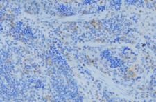 KRT77 / Keratin 77 / KRT1B Antibody - 1:100 staining human lymph node tissue by IHC-P. The sample was formaldehyde fixed and a heat mediated antigen retrieval step in citrate buffer was performed. The sample was then blocked and incubated with the antibody for 1.5 hours at 22°C. An HRP conjugated goat anti-rabbit antibody was used as the secondary.