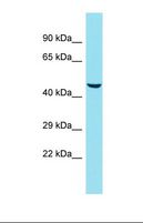 KRT78 / Keratin 78 Antibody - Western blot of Human HepG2. KRT78 antibody dilution 1.0 ug/ml.  This image was taken for the unconjugated form of this product. Other forms have not been tested.
