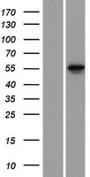 KRT78 / Keratin 78 Protein - Western validation with an anti-DDK antibody * L: Control HEK293 lysate R: Over-expression lysate