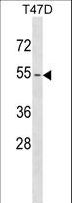KRT79 / Keratin 79 Antibody - KRT79 Antibody western blot of T47D cell line lysates (35 ug/lane). The KRT79 antibody detected the KRT79 protein (arrow).