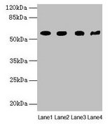 KRT79 / Keratin 79 Antibody - Western blot All lanes: KRT79 antibody at 1µg/ml Lane 1: Mouse lung tissue Lane 2: A549 whole cell lysate Lane 3: 293T whole cell lysate Lane 4: Mouse gonadal tissue Secondary Goat polyclonal to rabbit IgG at 1/10000 dilution Predicted band size: 58 kDa Observed band size: 58 kDa