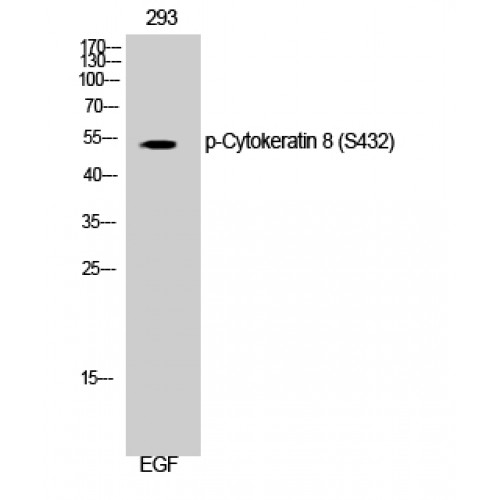 KRT8 / CK8 / Cytokeratin 8 Antibody - Western blot of Phospho-Cytokeratin 8 (S432) antibody