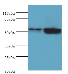 KRT8 / CK8 / Cytokeratin 8 Antibody - Western blot. All lanes: KRT8 antibody at 2 ug/ml. Lane 1: A549 whole cell lysate Lane 2: MCF-7 whole cell lysate. Secondary antibody: goat polyclonal to rabbit at 1:10000 dilution. Predicted band size: 54 kDa. Observed band size: 54 kDa.  This image was taken for the unconjugated form of this product. Other forms have not been tested.