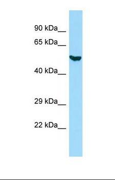 KRT8 / CK8 / Cytokeratin 8 Antibody - Western blot of Human HepG2 whole cell lysate. KRT8 antibody dilution 1.0 ug/ml.  This image was taken for the unconjugated form of this product. Other forms have not been tested.