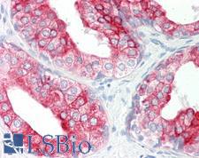 KRT8 / CK8 / Cytokeratin 8 Antibody - Human Prostate: Formalin-Fixed, Paraffin-Embedded (FFPE).  This image was taken for the unconjugated form of this product. Other forms have not been tested.