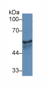 KRT8 / CK8 / Cytokeratin 8 Antibody - Western Blot; Sample: Human A431 cell lysate; Primary Ab: 1µg/ml Rabbit Anti-Rat KRT8 Antibody Second Ab: 0.2µg/mL HRP-Linked Caprine Anti-Rabbit IgG Polyclonal Antibody