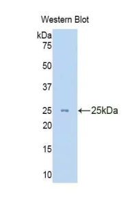 KRT8 / CK8 / Cytokeratin 8 Antibody - Western blot of recombinant KRT8 / CK8 / Cytokeratin 8.  This image was taken for the unconjugated form of this product. Other forms have not been tested.