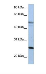 KRT8 / CK8 / Cytokeratin 8 Antibody - HepG2 cell lysate. Antibody concentration: 1.0 ug/ml. Gel concentration: 12%.  This image was taken for the unconjugated form of this product. Other forms have not been tested.