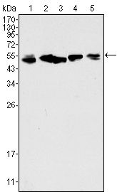 KRT8 / CK8 / Cytokeratin 8 Antibody