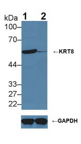 KRT8 / CK8 / Cytokeratin 8 Antibody - Knockout Varification: Lane 1: Wild-type Hela cell lysate; Lane 2: KRT8 knockout Hela cell lysate; Predicted MW: 54,57kDa Observed MW: 57kDa Primary Ab: 2µg/ml Rabbit Anti-Human KRT8 Antibody Second Ab: 0.2µg/mL HRP-Linked Caprine Anti-Rabbit IgG Polyclonal Antibody