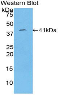 KRT8 / CK8 / Cytokeratin 8 Antibody - Western blot of recombinant KRT8 / CK8 / Cytokeratin 8.  This image was taken for the unconjugated form of this product. Other forms have not been tested.