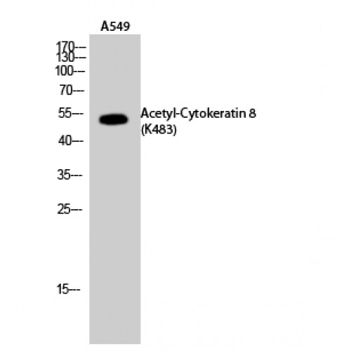 KRT8 / CK8 / Cytokeratin 8 Antibody - Western blot of Acetyl-Cytokeratin 8 (K483) antibody