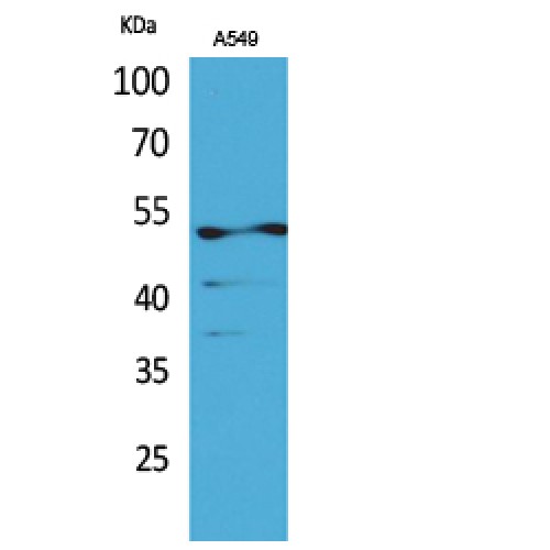 KRT8 / CK8 / Cytokeratin 8 Antibody - Western blot of Acetyl-Cytokeratin 8 (K483) antibody