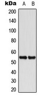 KRT8 / CK8 / Cytokeratin 8 Antibody - Western blot analysis of Cytokeratin 8 expression in HeLa (A); A431 (B) whole cell lysates.