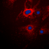 KRT8 / CK8 / Cytokeratin 8 Antibody - Immunofluorescent analysis of Cytokeratin 8 staining in HeLa cells. Formalin-fixed cells were permeabilized with 0.1% Triton X-100 in TBS for 5-10 minutes and blocked with 3% BSA-PBS for 30 minutes at room temperature. Cells were probed with the primary antibody in 3% BSA-PBS and incubated overnight at 4 C in a humidified chamber. Cells were washed with PBST and incubated with a DyLight 594-conjugated secondary antibody (red) in PBS at room temperature in the dark. DAPI was used to stain the cell nuclei (blue).